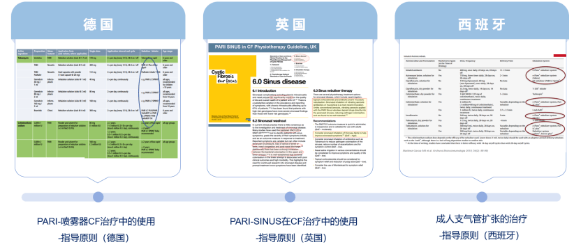 PARI的雾化杯怎么样？值得买吗？深度解析其核心技术与临床价值
